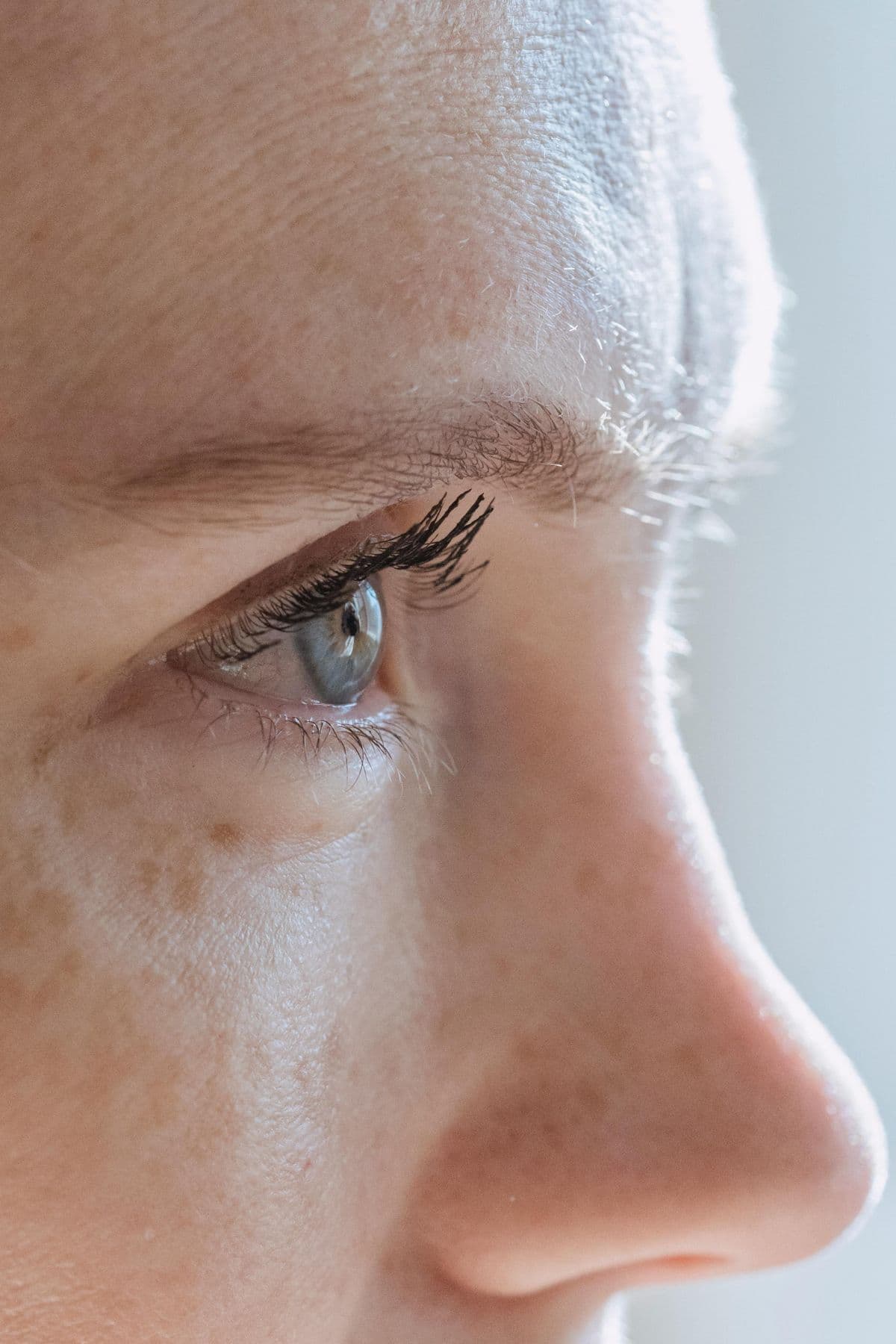 Can Botox© and Similar Products Improve the Appearance of Scars?